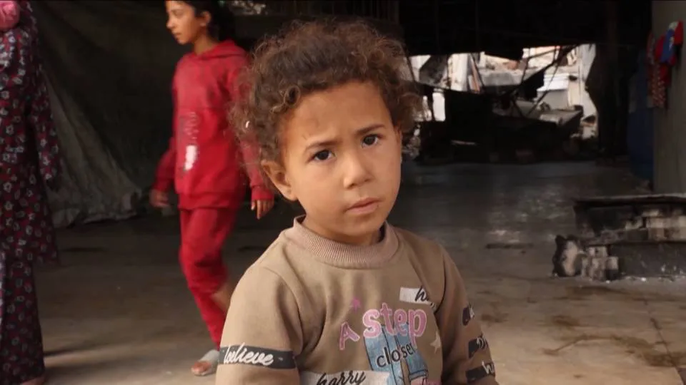 hl2-Gaza-malnutrition